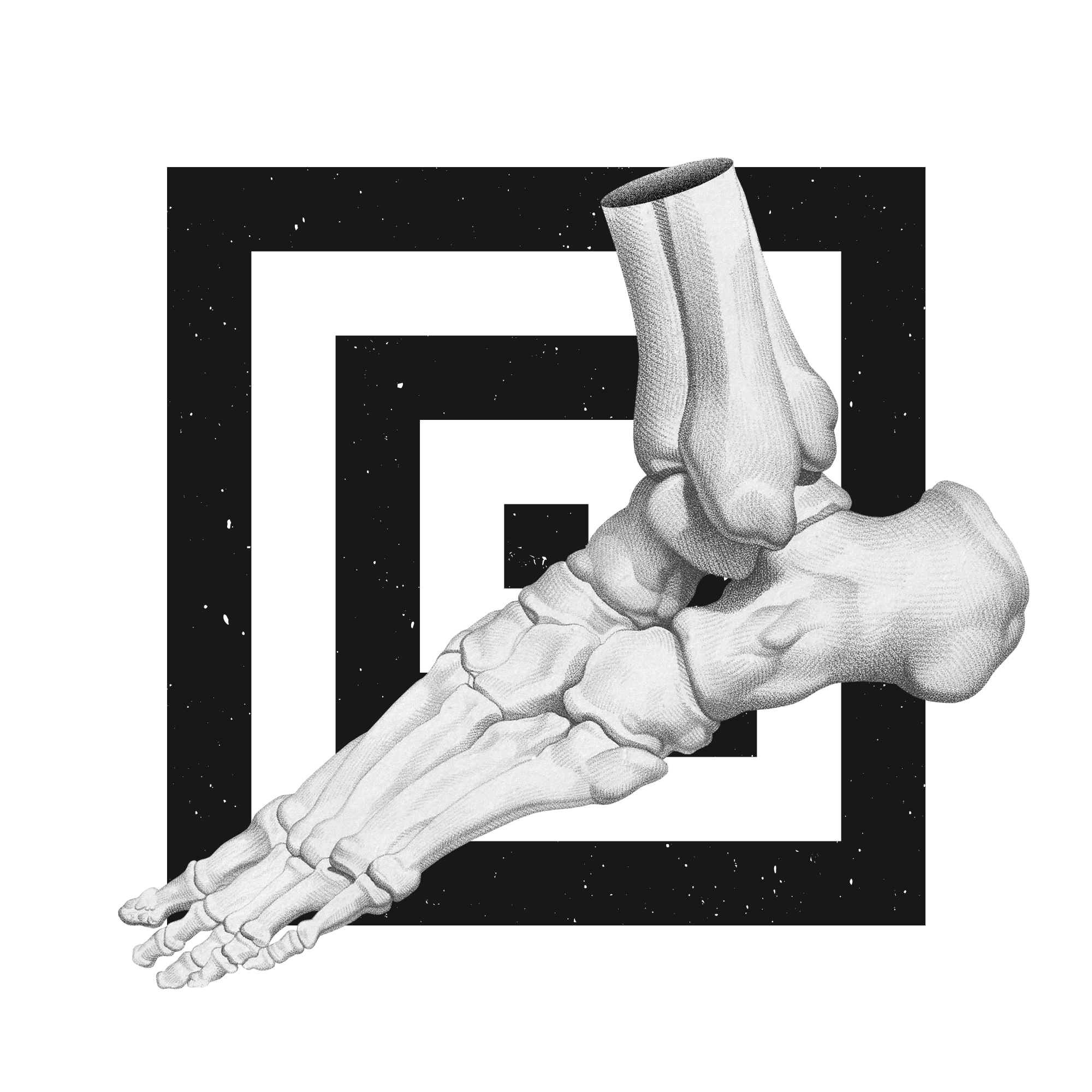 The Sprained Ankle Clinic